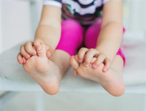 How To Protect Your Childrens Feet From Plantar Warts