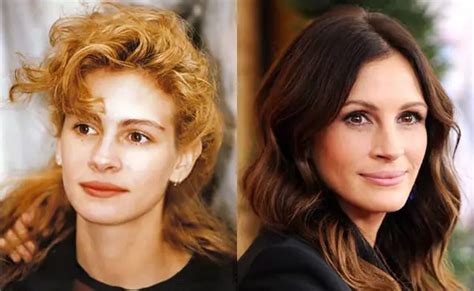 Julia Roberts Plastic Surgery Before And After Celebie
