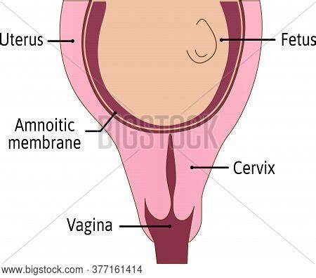 Cervix Not Effaced Vector Photo Free Trial Bigstock