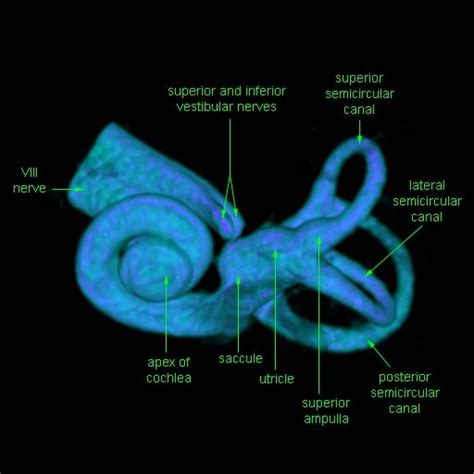 Great Images Of Ct And 3d Scans Of The Inner Ear There Are 3d Images