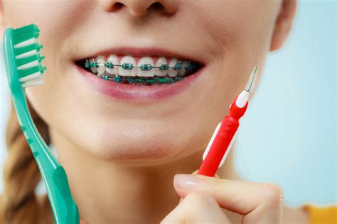 Oral Hygiene With Braces Corpus Christi Star Orthodontics