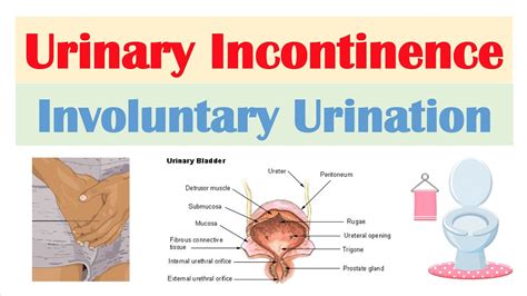 Urinary Incontinence Stress Urge Overflow And Functional Causes Symptoms Diagnosis