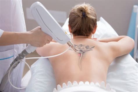 How much does a mowgli tattoo cost. How Much Does Tattoo Removal Cost? - Better Off