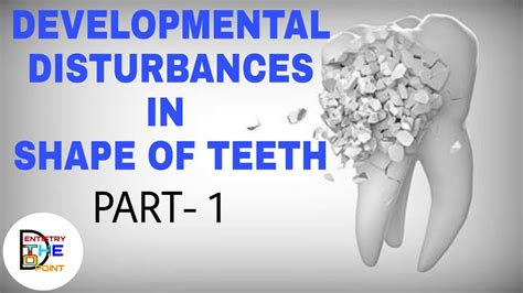 Developmental Disturbances In Shape Of Teeth Part 1 Youtube