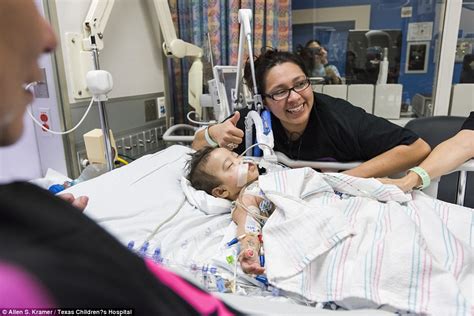 Cojoined Texas Twins Survive World First Operation To Separate Them Daily Mail Online