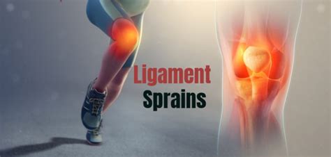 Ligament Sprains Tearing Or Stretching Of Ligaments Bodybuilding Wizard