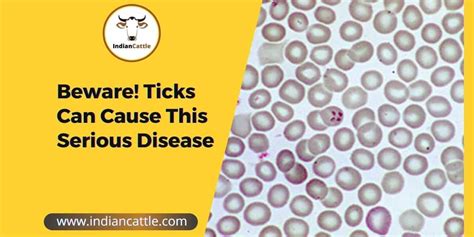 Diagnosis And Treatment Of Babesiosis In Cattle Tick Fever