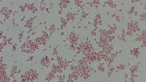 Klebsiella Pneumoniae Gram Stained Footages Under The Microscope Gram