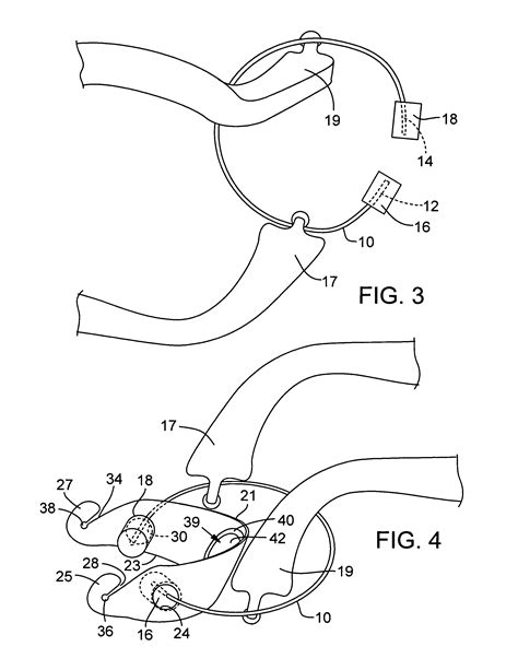 Patent Us7214058 Dental Matrix Positioned By Slidably Engaged Matrix