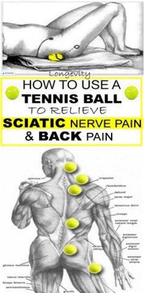Sciatica pain is likely caused by a herniated disc, pinched nerve, degenerative disc disease, or a narrowing of your spinal canal. Pin on Back pain