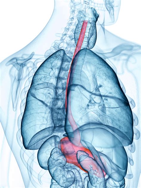 Esophagus Disorders | MedlinePlus