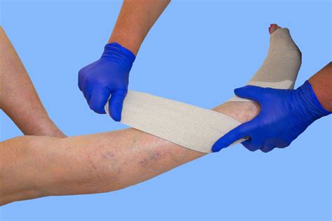 Benefits And Uses Of Compression Therapy In Wound Care