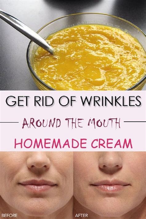 How To Get Rid Of Wrinkles Easy Homemade Remedy To Remove Wrinkles