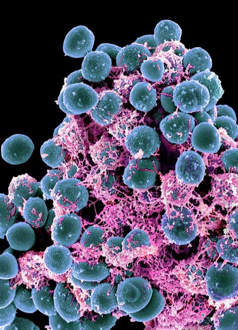 staphylococcus epidermidis بكتيريا