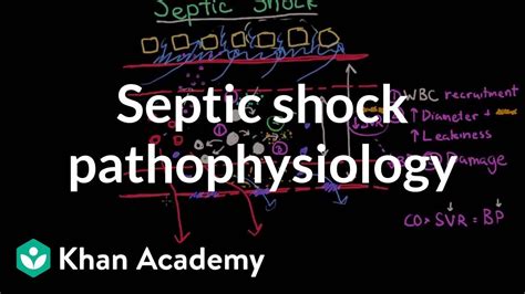 Septic Shock Pathophysiology And Symptoms Nclex Rn Khan Academy