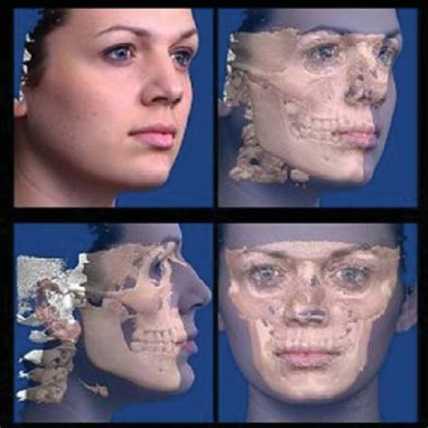A Co Registered 3d Facial Scan And 3d X Ray Data As Seen From Download Scientific Diagram