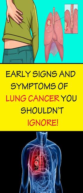 Early Warning Symptoms Of Lung Cancer You Shouldnt Ignore Healthcare