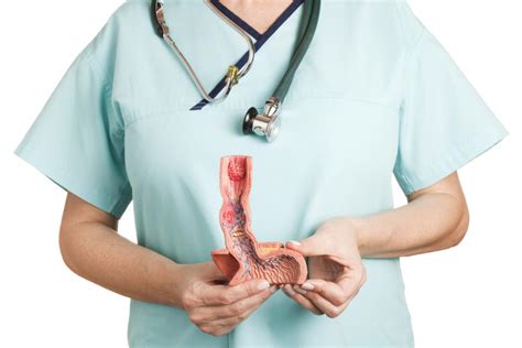 Esophageal Ulcers Symptoms Causes And Treatment
