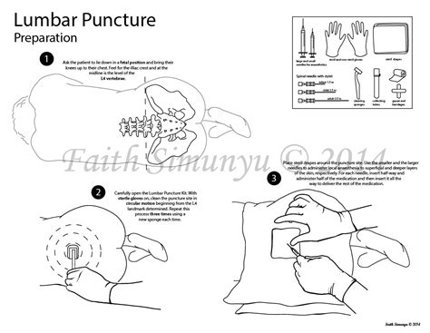 How To Perform A Lumbar Puncture A Collision Course