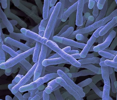 Mycobacterium Smegmatis Bacteria Sem Stock Image F0110301