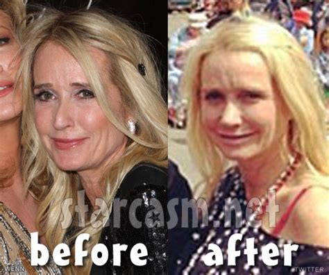 Transgender actress jen richards is upset with the fallout of louis c.k.'s actions after she lost a role on one of his planned tv shows. Kim Richards before and after nose job photos - starcasm.net