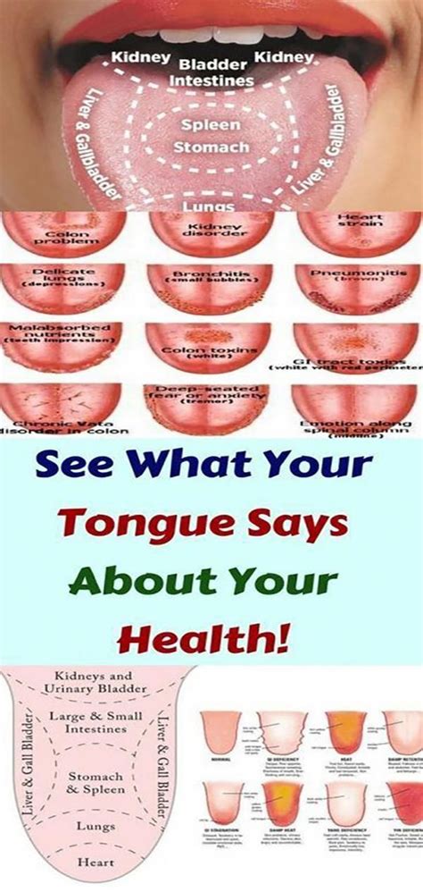 what your tongue is trying to tell you about your health tongue health health natural medicine