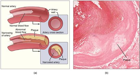 Blood Flow Blood Pressure And Resistance · Anatomy And Physiology