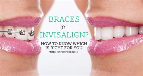 Braces Or Invisalign How To Know Which Is Right For You Fun Cheap Or Free