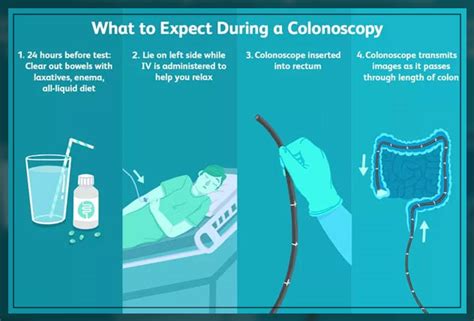 Colonoscopy Procedure Uses And More Engiomed