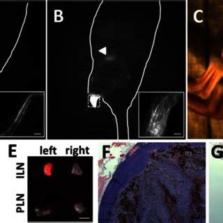 Magnified Fluorescent Images Showing Lymphatic Vessel Dilation In The Download Scientific