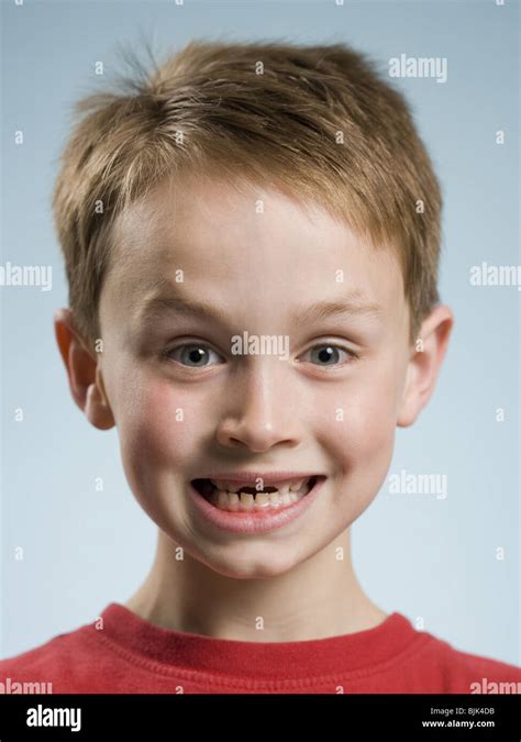 Baby Teeth Missing Hi Res Stock Photography And Images Alamy