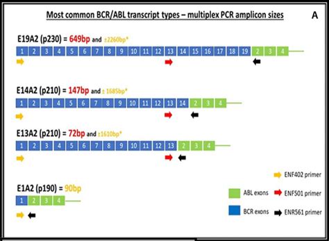 It also shows how drugs targeting this protein can help treat chronic myeloid leukemia (cml), a cancer of the white. Multiplex BCR/ABL PCR assay design | Download Scientific ...