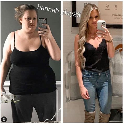 This Is Us Kate Weight Loss Before And After Bmi Formula