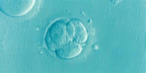 Ivf Fertility Treatment Explained In Vitro Fertilization