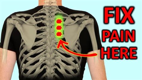 Pinched Nerve In Shoulder Shoulder Pain Relief Neck Pain Relief Neck