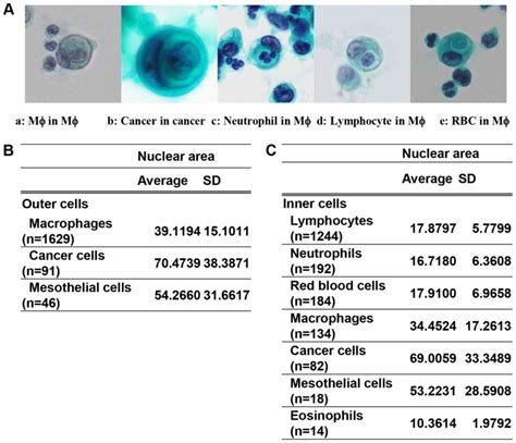 High Neutrophil Incorporation Rate Of Ascitic Fluid Cytology As An