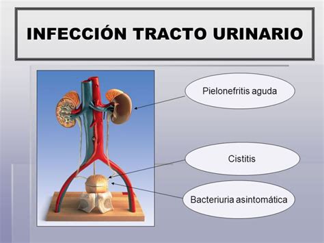 Qué son las infecciones del tracto urinario