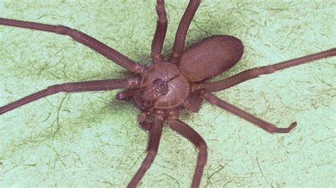 Missouri Doctors Find Venomous Brown Recluse Spider In Womans Ear