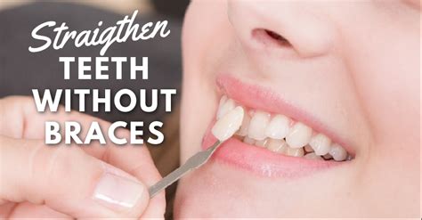 The perfect smile is something everyone wants, no matter what age. How to Straighten Teeth Without Braces | TDS, Singapore