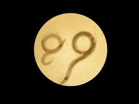 Vista al microscopio del gusano Aspiculuris un parásito intestinal