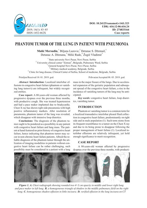 Pdf Phantom Tumor Of The Lung In Patient With Pneumonia