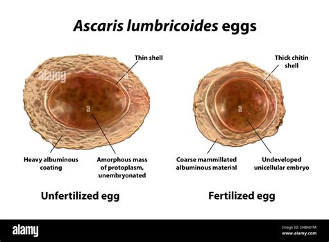 Illustration Of The Unfertilized And Fertilized Eggs Of Ascaris