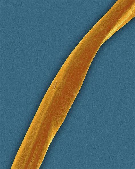 Human Pubic Hair Photograph By Dennis Kunkel Microscopy Science Photo