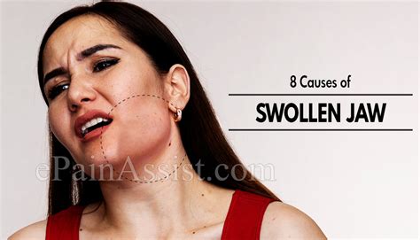 8 Causes Of Swollen Jaw