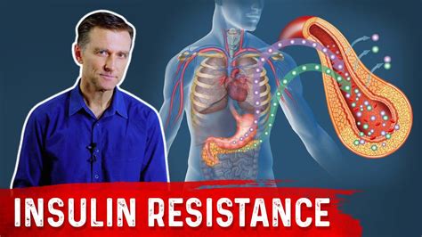 28 Insulin Resistance Symptoms Drberg