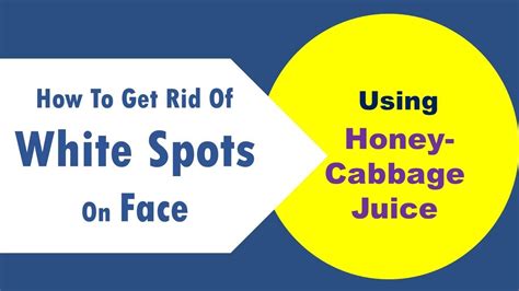 How To Get Rid Of White Spots On Face Using Honey And Cabbage Juice Youtube