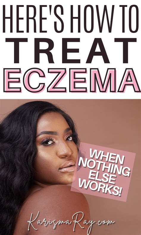 It Almost Ruined My Childhood Heres How To Treat Eczema In 2021