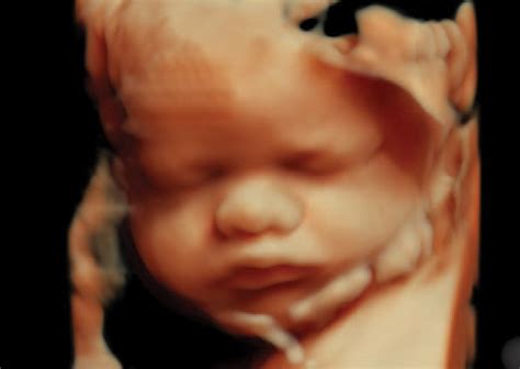 3d4d Ultrasound Expert Pregnancy Imagining Minnesota Womens Care