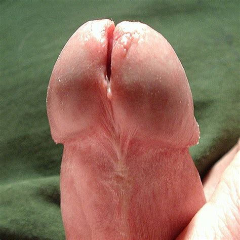 Split Penis Modification Mega Porn Pics