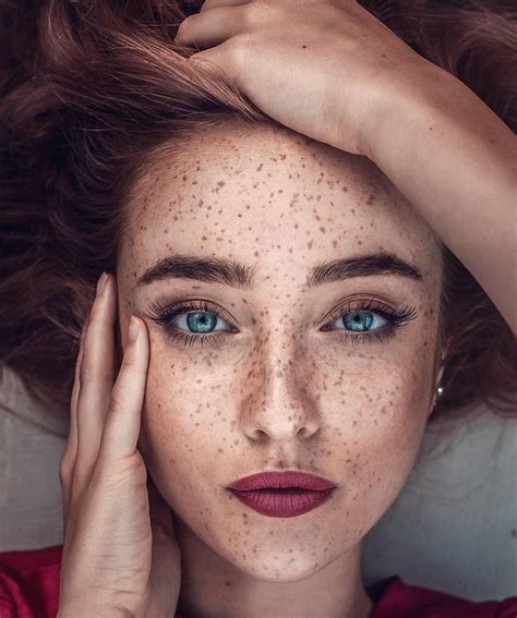 A Woman With Freckles On Her Face And Hands Over Her Head Looking At